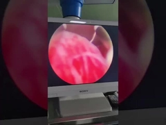 Urology or Gynaecology Sugery