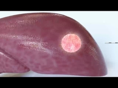 rf ablation multi needle electrodes for all kinds of tumor surgery