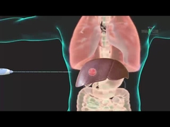 Radio Frequency Electrode for Ablation of Hepatectomy