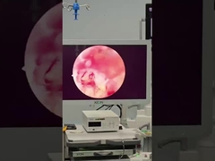 UBE Surgery by DaMai Plasma Surgery Probe