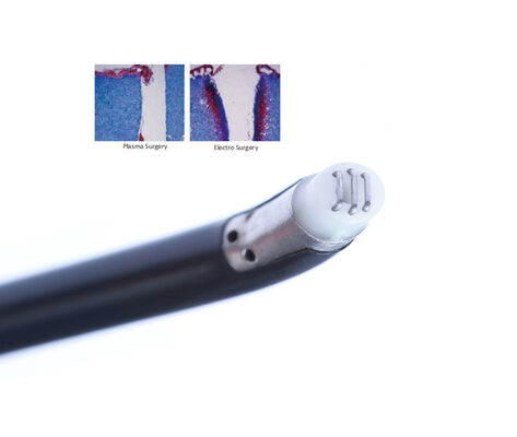 Bom preço Tonsilhectomia Sonda Plasma Wand ENT para Cirurgia de Plasma em Tonsilhectomia Eficaz para o Tratamento de Ataques Agudos Repetidos de Tonsillite Crônica em linha